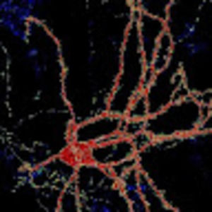 Meet your Posher, Douglas